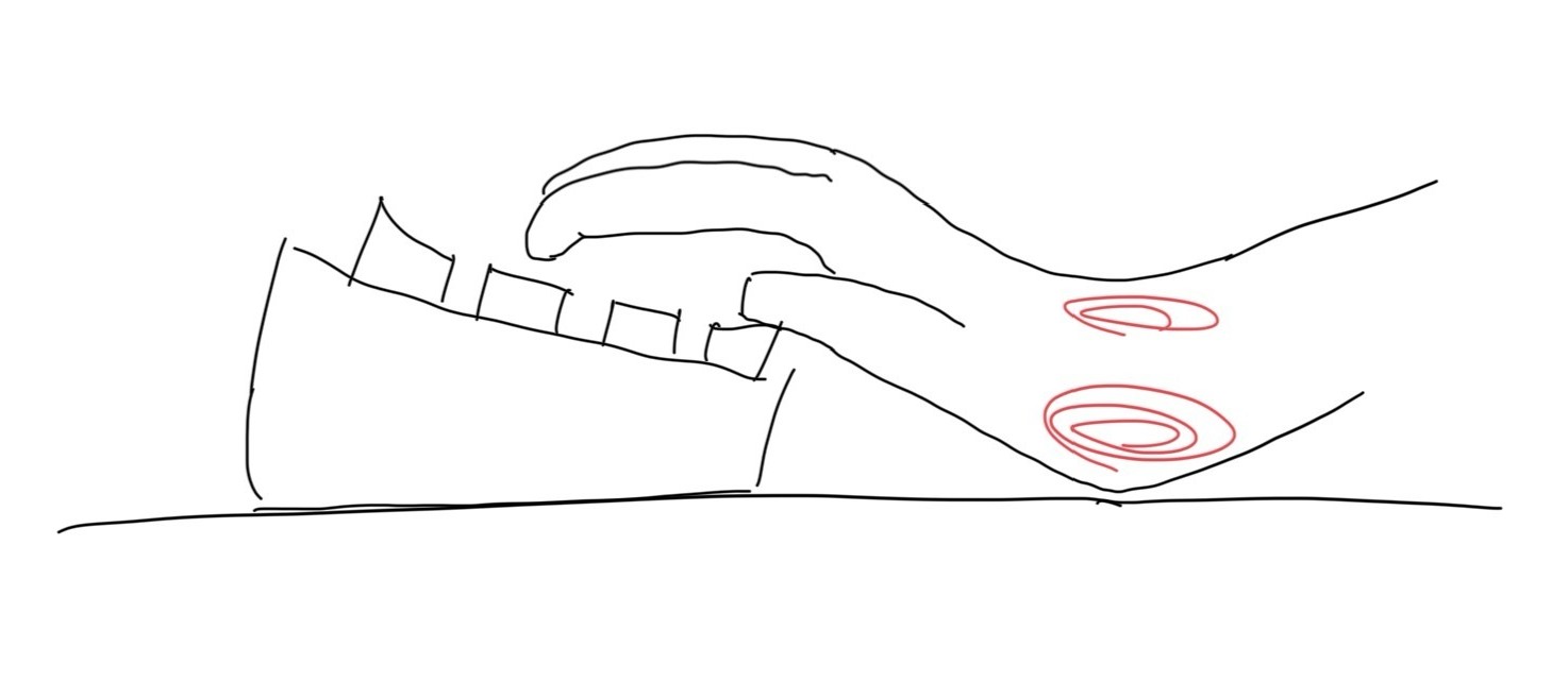 手首が痛い画像